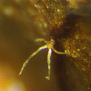 Hamamelis virginiana, American Witch Hazel, microscope closeup, stellar hair